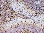 IHC testing of FFPE mouse spleen tissue with ADA antibody at 1ug/ml. Required HIER: steam section in pH6 citrate buffer for 20 min and allow to cool prior to testing.
