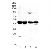 Western blot testing of 1) mouse testis, 2) mouse ovary, 3) rat stomach and 4) rat ovary lysate with Ada antibody at 0.5ug/ml. Predicted molecular weight ~41 kDa.