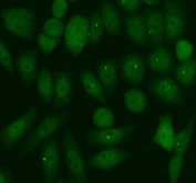 Immunofluorescent staining of FFPE human SiHa cells with PER1 antibody (green). HIER: steam section in pH6 citrate buffer for 20 min.