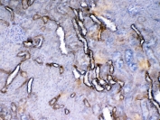 IHC testing of FFPE rat kidney tissue with Vegf receptor 2 antibody at 1ug/ml. Required HIER: steam section in pH6 citrate buffer for 20 min and allow to cool prior to testing.