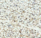 IHC staining of FFPE mouse adipose tissue with CFD antibody. Required HIER: steam section in pH8 EDTA buffer for 20 min and allow to cool prior to testing.