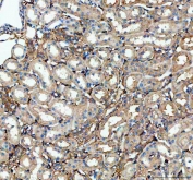 IHC staining of FFPE rat kidney tissue with CFD antibody. Required HIER: steam section in pH8 EDTA buffer for 20 min and allow to cool prior to testing.