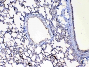 IHC testing of FFPE mouse lung tissue with Factor D antibody at 1ug/ml. Required HIER: steam section in pH6 citrate buffer for 20 min and allow to cool prior to testing.