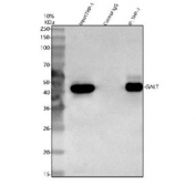 Immunoprecipitation of GALT protein from 500ug of human ThP-1 whole cell lysate with 2ug of GALT antibody.