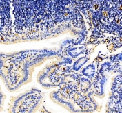 IHC staining of FFPE mouse colon tissue with CD31 antibody. HIER: boil tissue sections in pH8 EDTA for 20 min and allow to cool before testing.