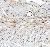 IHC staining of FFPE mouse heart tissue with CD31 antibody. HIER: boil tissue sections in pH8 EDTA for 20 min and allow to cool before testing.
