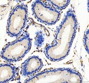 IHC staining of FFPE mouse epididymis tissue with CD31 antibody. HIER: boil tissue sections in pH8 EDTA for 20 min and allow to cool before testing.