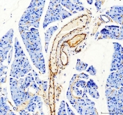 IHC staining of FFPE mouse pancreas tissue with CD31 antibody. HIER: boil tissue sections in pH8 EDTA for 20 min and allow to cool before testing.
