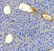 IHC staining of FFPE mouse liver tissue with CD31 antibody. HIER: boil tissue sections in pH8 EDTA for 20 min and allow to cool before testing.