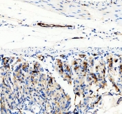 IHC staining of FFPE mouse stomach tissue with CD31 antibody. HIER: boil tissue sections in pH8 EDTA for 20 min and allow to cool before testing.