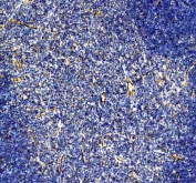 IHC staining of FFPE mouse thymus tissue with CD31 antibody. HIER: boil tissue sections in pH8 EDTA for 20 min and allow to cool before testing.