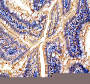 IHC staining of FFPE rat colon tissue with NMU antibody, HRP-secondary and DAB substrate. HIER: boil tissue sections in pH8 EDTA for 20 min and allow to cool before testing.
