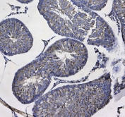 IHC testing of FFPE rat testis tissue with GSTM3 antibody at 1ug/ml. Required HIER: steam section in pH6 citrate buffer for 20 min and allow to cool prior to testing.