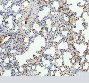 IHC staining of FFPE rat lung tissue with TSPAN12 antibody, HRP-labeled secondary and DAB substrate. HIER: boil tissue sections in pH8 EDTA for 20 min and allow to cool before testing.
