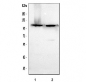 Western blot testing of human 1) MOLT4 and 2) U-87 MG cell lysate with RECK antibody at 0.5ug/ml. Predicted molecular weight ~106 kDa.
