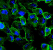 Immunofluorescent staining of FFPE human HeLa cells with AMOTL2 antibody (green) and DAPI nuclear stain (blue). HIER: steam section in pH6 citrate buffer for 20 min.