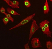 Immunofluorescent staining of FFPE human A549 cells with SP6 antibody (green) and Beta Tubulin mAb (red). HIER: steam section in pH6 citrate buffer for 20 min.