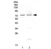 Western blot testing of human 1) COLO320 and 2) U-87 MG cell lysate with CHM antibody at 0.5ug/ml. Predicted molecular weight ~73 kDa.