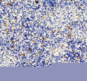 IHC staining of FFPE human spleen tissue with DC-SIGN antibody, HRP-secondary and DAB substrate. HIER: boil tissue sections in pH8 EDTA for 20 min and allow to cool before testing.