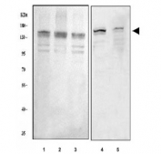 Western blot testing of 1) human 293T, 2) human MCF7, 3) human Caco-2, 4) rat C6 and 5) mouse NIH 3T3 cell lysate with ASXL1 antibody. Predicted molecular weight ~165 kDa.
