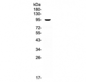 Western blot testing of 1ng of human recombinant protein with VCAM1 antibody at 0.5ug/ml. Expected molecular weight: 74-110 kDa depending on glycosylation level.