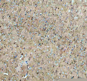 IHC staining of FFPE rat brain tissue with Neuropeptide S antibody. HIER: boil tissue sections in pH8 EDTA for 20 min and allow to cool before testing.