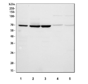 Western blot testing of 1) human Jurkat, 2) human 293T, 3) human HepG2, 4) rat brain and 5) mouse brain tissue lysate with cIAP1 antibody at 0.5ug/ml. Predicted molecular weight ~70 kDa.