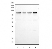 Western blot testing of human 1) Jurkat, 2) A431, 3) HeLa and 4) K562 cell lysate wtih CD2AP antibody. Predicted molecular weight: 71-80 kDa.