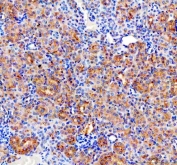 IHC staining of FFPE mouse kidney tissue with CD2AP antibody. HIER: boil tissue sections in pH8 EDTA for 20 min and allow to cool before testing.