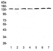 Western blot testing of human 1) HeLa, 2) COLO320, 3) A549, 4) SK-OV-3, 5) A431, 6) rat brain and 7) mouse brain lysate with PERK antibody at 0.5ug/ml. Predicted molecular weight ~125 kDa, observed here at ~140 kDa.