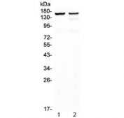 Western blot testing of 1) rat heart and 2) mouse heart lysate with MYBPC3 antibody at 0.5ug/ml. Predicted molecular weight ~141 kDa.