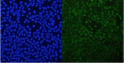 Immunofluorescent staining of FFPE human A431 cells with GNB1 antibody (green) at 2ug/ml and DAPI nuclear stain (blue). HIER: steam section in pH6 citrate buffer for 20 min.