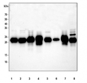 Western blot testing of human 1) HeLa, 2) MCF7, 3) COLO-320, 4) 22RV1, 5) HepG2, 6) A431, 7) U937 and 8) ThP-1 cell lysate with GLO1 antibody at 0.5ug/ml. Predicted molecular weight ~21 kDa.