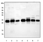 Western blot testing of 1) rat brain, 2) rat spleen, 3) rat thymus, 4) mouse brain, 5) mouse spleen, 6) mouse thymus and 7) mouse NIH 3T3 cell lysate with GLO1 antibody at 0.5ug/ml. Predicted molecular weight ~21 kDa.
