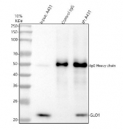 Immunoprecipitation of GLO1 protein from 500ug of human A431 whole cell lysate with 2ug of GLO1 antibody.