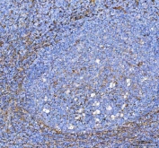 IHC staining of FFPE human tonsil tissue with S100A10 antibody. HIER: boil tissue sections in pH8 EDTA for 20 min and allow to cool before testing.