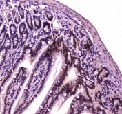 IHC testing of FFPE mouse small intestine tissue with BRG1 antibody at 1ug/ml. Required HIER: steam section in pH6 citrate buffer for 20 min and allow to cool prior to staining.