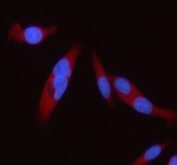 Immunofluorescent staining of FFPE human PC-3 cells with STAT2 antibody (red) and DAPI nuclear stain (blue). HIER: steam section in pH6 citrate buffer for 20 min.