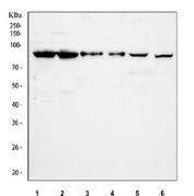 Western blot testing of 1) human HEL, 2) human Jurkat, 3) human 293T, 4) human K562, 5) rat testis and 6) mouse testis tissue lysate with PLA2G6 antibody at 0.5ug/ml. Expected molecular weight: 85-90 kDa.