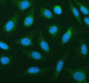 Immunofluorescent staining of FFPE human U-2 OS cells with PLA2G6 antibody (green) and DAPI nuclear stain (blue). HIER: steam section in pH6 citrate buffer for 20 min.
