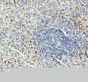 IHC staining of FFPE human spleen tissue with CD11b antibody, HRP-labeled secondary and DAB substrate. HIER: boil tissue sections in pH8 EDTA for 20 min and allow to cool before testing.