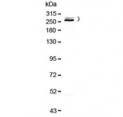 Western blot testing of human HepG2 cell lysate with Desmoplakin antibody at 0.5ug/ml. Predicted molecular weight: ~332 kDa (isoform DPI), ~260 kDa (isoform DPII), ~279 kDa (isoform DPIa).
