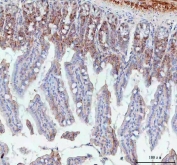 IHC staining of FFPE mouse intestine tissue with BCMA antibody. HIER: boil tissue sections in pH8 EDTA for 20 min and allow to cool before testing.