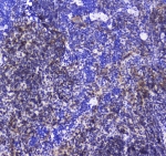IHC testing of FFPE mouse spleen tissue with SHIP1 antibody at 1ug/ml. Required HIER: steam section in pH6 citrate buffer for 20 min and allow to cool prior to staining.