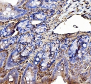 IHC testing of FFPE rat colon tissue with Annexin VI antibody. Required HIER: steam section in pH8 EDTA buffer for 20 min and allow to cool prior to staining.