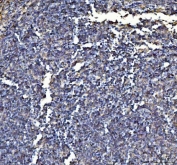 IHC testing of FFPE mouse lymph tissue with Annexin VI antibody. Required HIER: steam section in pH8 EDTA buffer for 20 min and allow to cool prior to staining.