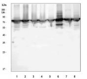 Western blot testing of 1) human placenta, 2) human Jurkat, 3) human HeLa, 4) human HepG2, 5) rat liver, 6) rat lung, 7) mouse liver and 8) mouse lung tissue lysate with Annexin VI antibody at 0.5ug/ml. Expected molecular weight: 67-76 kDa.