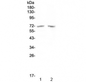 Western blot testing of human 1) MDA-MB-453 and 2) SW620 cell lysate with HDAC10 antibody at 0.5ug/ml. Predicted molecular weight ~71 kDa.