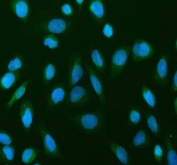 Immunofluorescent staining of FFPE human U-2 OS cells with p65 antibody (green) and DAPI nuclear stain (blue). HIER: steam section in pH6 citrate buffer for 20 min.
