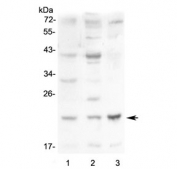 Western blot testing of 1) mouse small intestine, 2) mouse kidney and 3) mouse Neuro-2a lysate with Leptin antibody at 0.5ug/ml. Predicted molecular weight ~16 kDa.